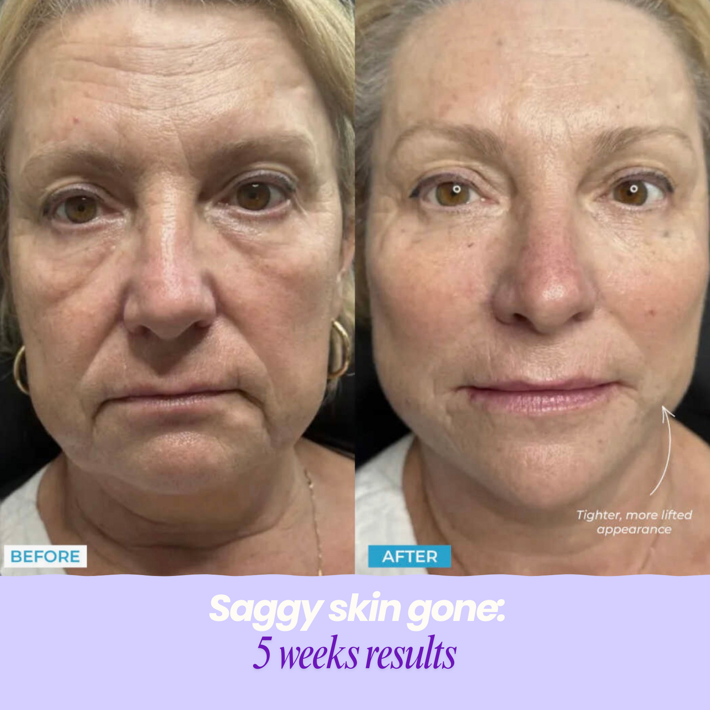 GlamLight Facial Sculptor