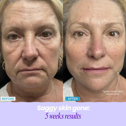 GlamLight Facial Sculptor